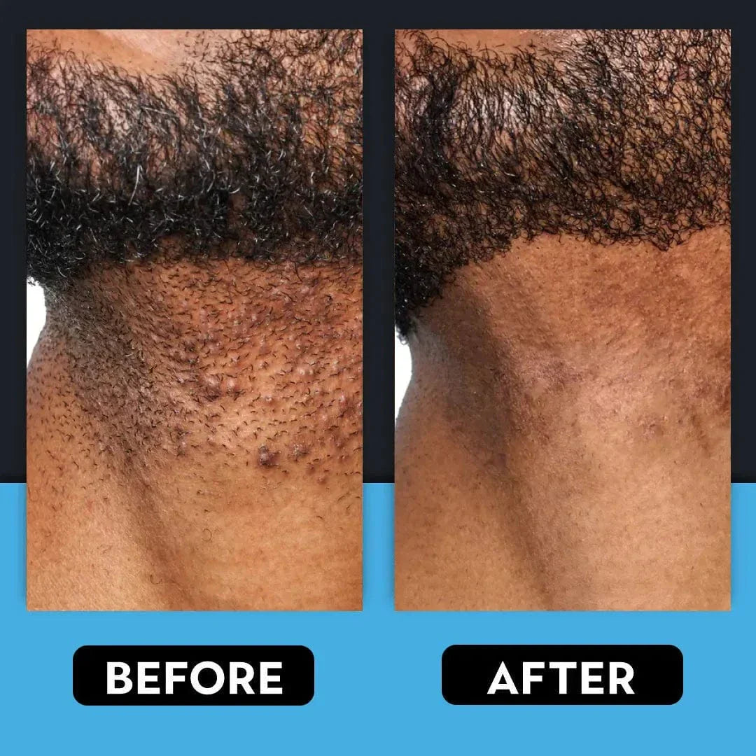 How to Shave Without Getting Razor Bumps: The Ultimate 2026 Tutorial