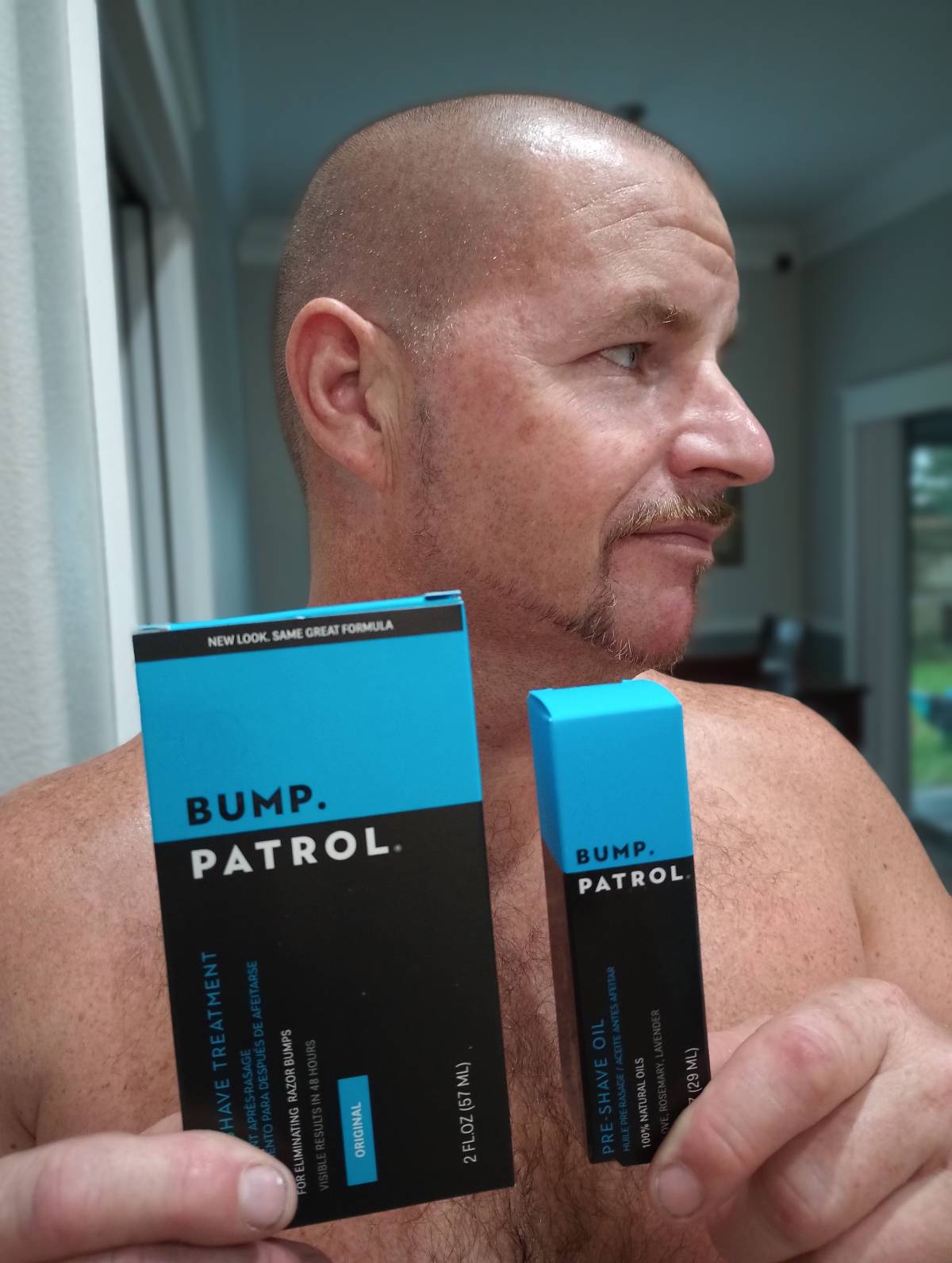 Ingrown Hairs: The Underlying Cause and Bump Patrol's Solution